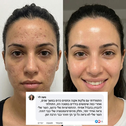 מסכת קולגן לעור הפנים עם מברשת