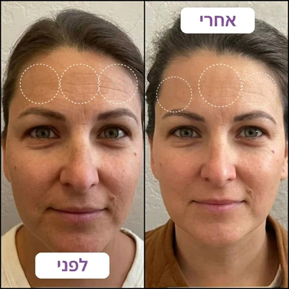 רטינל בוסטר לעור חלק וזוהר