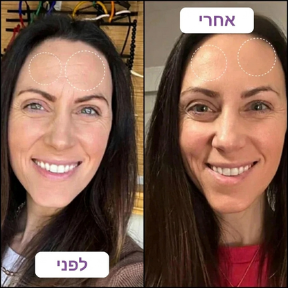 רטינל בוסטר לעור חלק וזוהר